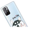 Coque Xiaomi Redmi Note 11 Pro/Note 11 Pro+ en TPU IMD - Smile